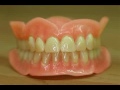 wax model in dentistry