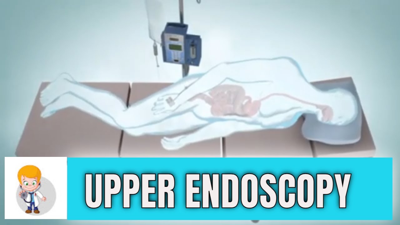 Upper Gi Endoscopy Esophagogastroduodenoscopy Animation 3d Youtube