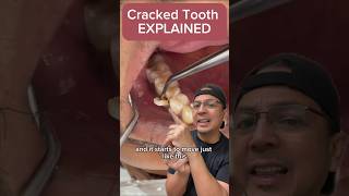 What to Do if You Have a Cracked Tooth | View Mobile Dental #shorts