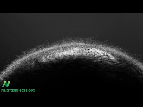 Intravenous Vitamin C for Terminal Cancer Patients Intravenous Vitamin C for Terminal Cancer Patients