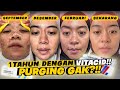 1 TAHUN DENGAN TRETINOIN