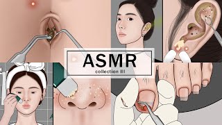 ASMR Body Treatments! Navel Stone, Ingrown Toenail,  Ear Cleaning, Blackheads | Meng's Stop Motion