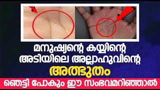 മനുഷ്യന്റെ കയ്യിന്റെ അടിയിലെ അല്ലാഹുവിന്റെ അത്ഭുതം  ഞെട്ടി പോകും ഈ സംഭവമറിഞ്ഞാൽ