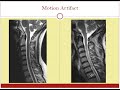 mri safety and contraindications