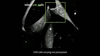 Label free live cell imaging of macropinocytosis