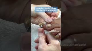 Toenail Transformation ASMR Relaxing Sounds