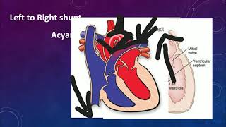 Congenital Heart Disease|Tamil |Mightymedicoz