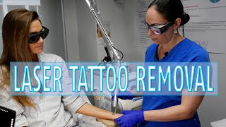 LASER TATTOO REMOVAL - Arviv Aesthetics - Dr Tali Arviv