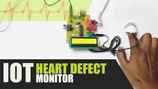 DIY IOT Based Heart Defect Monitoring System Using ECG IOT Health Project