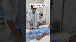 Demonstration of Water Hammer Pulse - In Aortic Regurgitation #medical #medicine #doctor