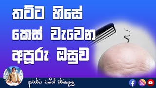 Amazing Hair Growth Herb |තට්ට හිසේ කෙස් වැවෙන අපූරු ඔසුව | Dr. Chamin Warnakula