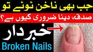 Nakhun Tote to Khabardar | Nakhoon Par Nishan | ناخن | nails | Nail | Mehrban Ali