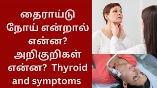 தைராய்டு நோய் என்றால் என்ன? அறிகுறிகள் என்ன? #thyroid symptoms #what is thyroid #