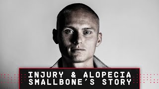 SMALLBONE'S STORY | Southampton youngster Will Smallbone on overcoming injury and alopecia