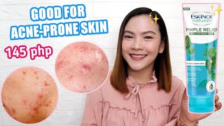 NO MORE ACNE USING ESKINOL PIMPLE RELIEF FACIAL WASH! 145 PESOS LANG!