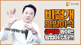 비절개 모발이식 생착률 높이는 법 소개해드립니다.