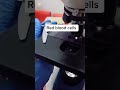 red blood cells rbcs analysis microscopicanalysis microscopy bloodtest experiment microbiology