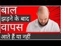 Do Hair Come Back After Losing or Not | Causes of Hair Loss | Hair Transplant | Hair Loss | VHCA