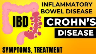 Inflammatory bowel disease | Corhns disease treatment | IBD symptoms and treatment in Hindi