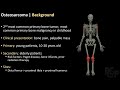 Learn Radiology- Bone Tumors (1/2) - RSCP Video Curriculum