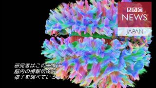 人の脳の3Dスキャン　驚くほど精緻な