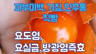 요도염,요실금,방광염,피부미백,인후통,기침에직빵,꽈리효능,Excellent for sore throat and cough,Immediate effect on urethritis,