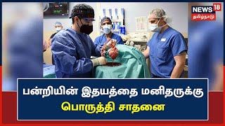 Pig Heart | மருத்துவ வரலாற்றில் பன்றியின் இதயத்தை மனிதனுக்குப் பொருத்தி சாதனை | USA