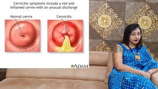 CERVICITIS - Inflammation Of Cervix / PID / Uterus Infection