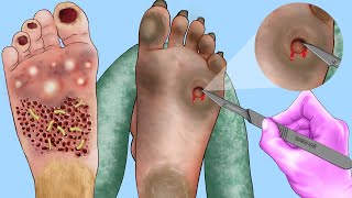 foot surgery asmr | asmr foot surgery animation | asmr foot surgery | asmr foot surgery animation