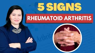 5 Signs of Rheumatoid Arthritis That You Should Not Ignore