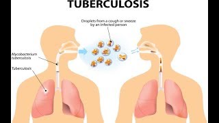 Microbiology of Tuberculosis