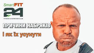 Причини набряків і як їх усунути