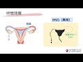 『子宮卵管造影検査（hsg）って痛い？？』ivf大阪クリニック positive 妊活！シリーズ