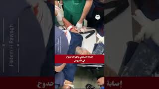 فيديو اثناء علاج الزميل الصحفي وائل الدحدوح ويتحدث فيه عن إصابة مصوره سامر ابو دقة  إصابة خطيرة ‼️