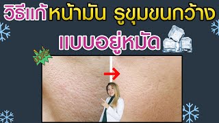 แก้ หน้ามัน รูขุมขนกว้าง ตามวิธีนี้ หายชัวร์ l กูรูยาหม่อง