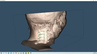 VTK Python Example - MedicalDemo2