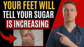 9 Warning Signs in Your Feet That Could Mean Diabetes