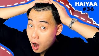 Nigel Got A Hair Transplant! | HAIYAA #36