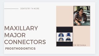 MAXILLARY MAJOR CONNECTORS