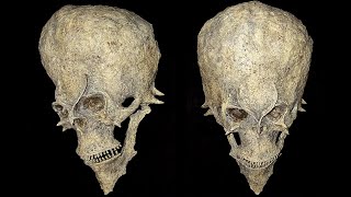 10 Most Bizarre Skulls & Skeleton Discoveries!