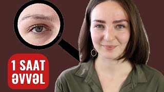 Tökülən Qaşlar bu yolla cəmi 1 saata BƏRPA EDİLİR - Nanobrows nədir?