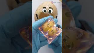 Potato C-Section - BABIES STILL IN AMNIOTIC SAC😱❤️ #fruitsurgery #animation #cute
