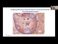 Subspecialty Lecture:  Antithrombosis and COVID-19 with Dr. Alex Spyropoulos