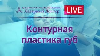 Контурная пластика губ - трансляция в Periscope