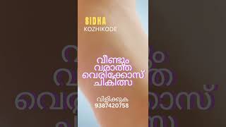 വെരിക്കോസ് വീണ്ടും വീണ്ടും വരാത്ത  രീതിയിലുള്ള ചികിത്സയ്ക്ക് ആവശ്യമുള്ളവർ മാത്രം വിളിക്കുക