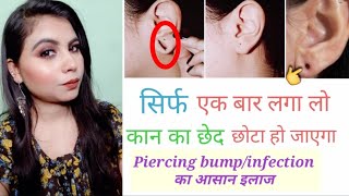 कान का छेद हमेशा के लिए छोटा करने का आसान उपाय Ear hole repair/ Ear hole closing without surgery ll