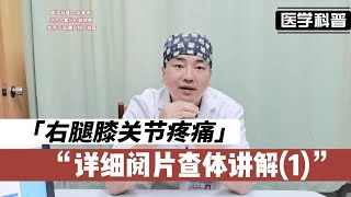 右腿膝关节疼痛怎么回事？肖医生详细阅片查体讲解(1)