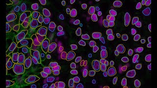 DeepCSeg: Deep learning cell segmentation