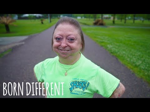 I’m 30 But Look 60 | BORN DIFFERENT I’m 30 But Look 60 | BORN DIFFERENT