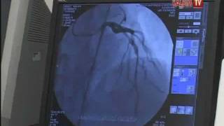 STENT HANGİ DURUMLARDA GEREKLİDİR ? FFR